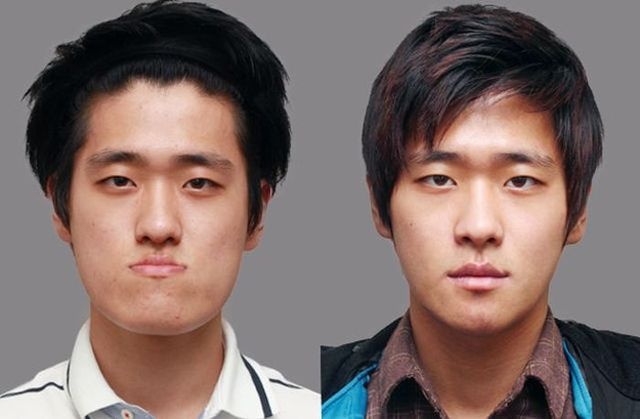 Plastic Surgery in Korea! 10 Pics!