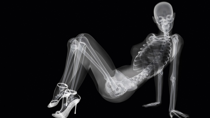 X-Rays: How Funny We May Look! 10 Pics!