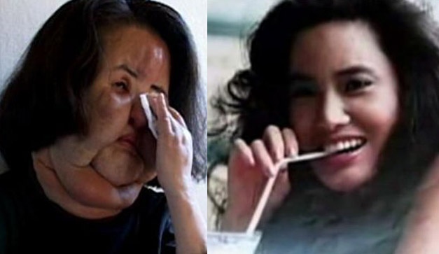 10 Famous But Worst Examples of Plastic Surgery Ever!