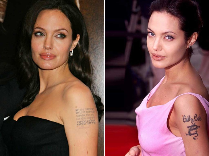 10 Celebs Who Removed Tattoo Mistakes!